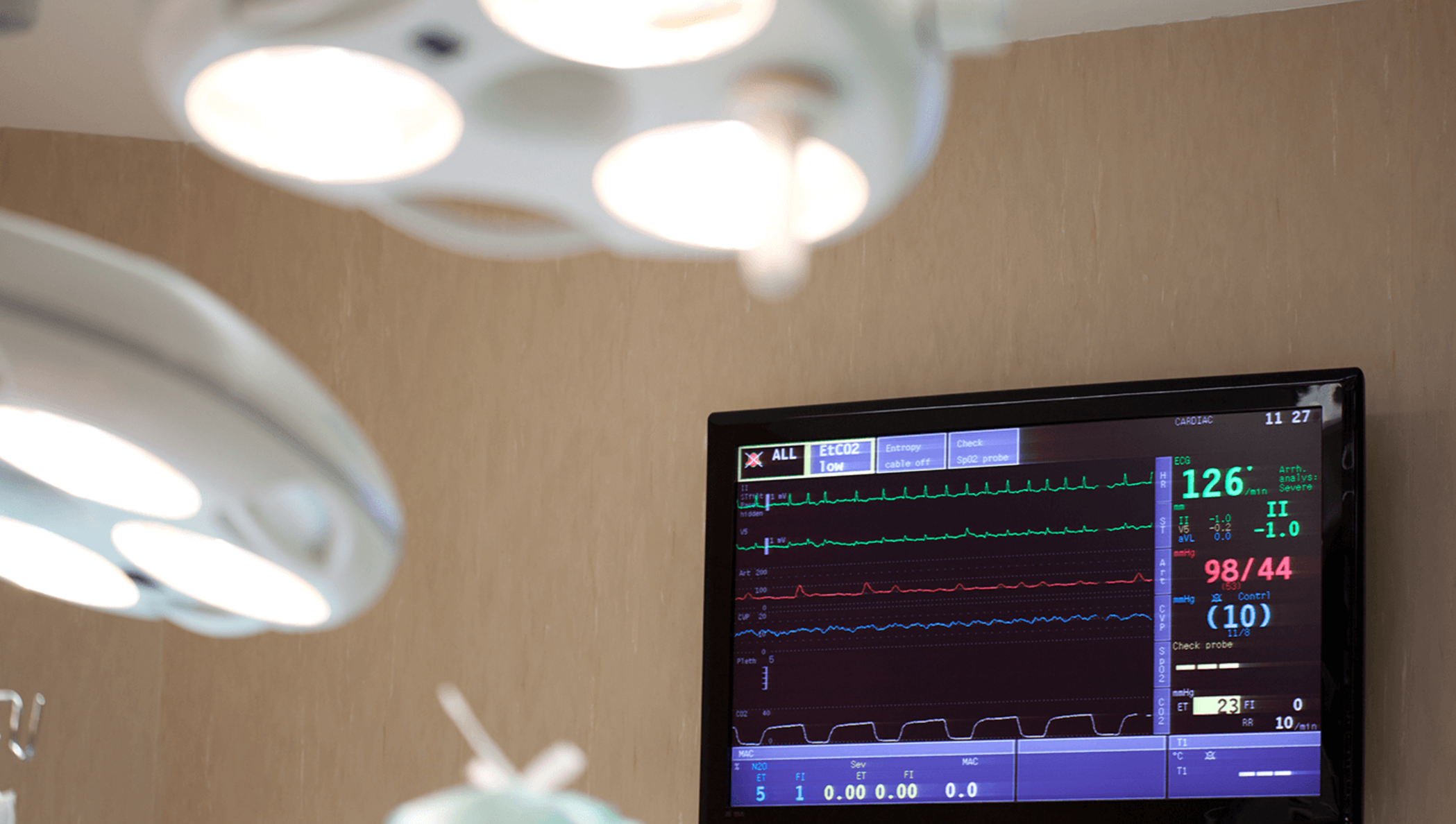 Un monitor de pulso cardiaco en un cuarto de hospital.